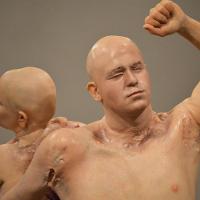 An exhibit of two hairless life-like figures, back to back, one with a raised arm, both with visible wounds and scarring 